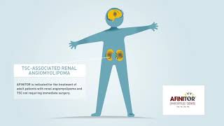 AFINITOR® everolimus Mechanism of Action in Renal Angiomyolipoma with TSC [upl. by Lynnet176]