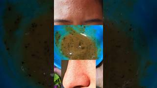 Blackheads whiteheads scrub  glowing skin remove dead skin cell♥️ natural scrub [upl. by Ettenej]