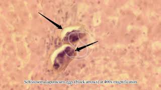 Schistosoma japonicum Egg in Tissue with Haematoxylin and Eosin HampE Stain [upl. by Krute952]