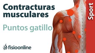 3 cosas que debes saber sobre las contracturas musculares y los puntos gatillo [upl. by Jeniffer]