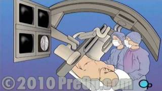 PreOp® Patient Education Cardiac Catheterization Angiography [upl. by Obe]