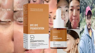 Dermatouch Bye Bye Pigmentation Serum  Honest Review [upl. by Erline]