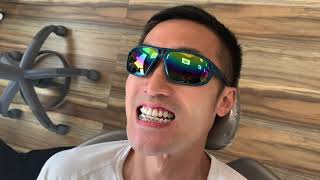 UNDERBITE JAW SURGERY VLOG 4  I GOT ADULT BRACES  How It’s Done  Exp  Type  Cost [upl. by Ioj]