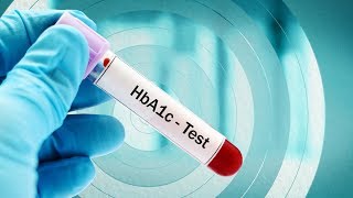 What is the Optimal HbA1c Target for Type 2 Diabetes Patients [upl. by Airtal]