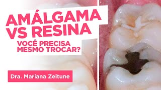 Restauração ou Obturação com Amálgama ou Resina Saiba tudo sobre  Dra Mariana Zeitune [upl. by Rema]