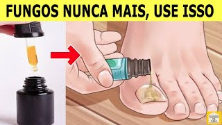 👣REMOVE FUNGOS SÓ 3 Gotas Deste Óleo Para Eliminar os FUNGOS DAS UNHAS em Poucos Dias [upl. by Demy]