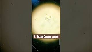 E histolytica cysts  Amoebiasis [upl. by Jepum]