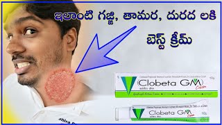 Clobeta Gm cream uses in telugu  best cream for ellergy  అన్ని రకాల దురద లకి మంచి క్రీమ్ [upl. by Eillor]