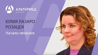 Розацеа Начало лечения [upl. by Enomad]