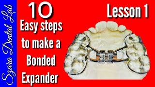 How to make a Orthodontic Bonded palatal expander [upl. by Emmey]