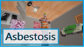 Asbestosis Mnemonic for the USMLE [upl. by Ahsircal18]