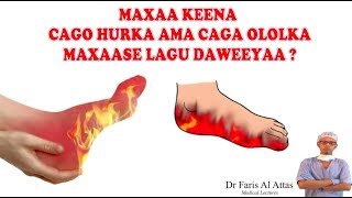 MAXAA KEENA CAGO HURKA AMA CAGA OLOLKA MAXAASE LAGU DAWEEYAA Dr faris [upl. by Bella630]