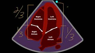 POCUS  Assessing Cardiac Chamber Size [upl. by Rosemaria]