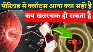 period में खून के थक्के क्यों आते हैं। इनफर्टिलिटी। Period 🩸 में ज्यादा खून आने की समस्या [upl. by Sillek]