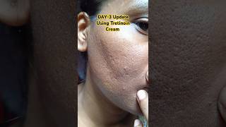 Day3 Update Using Tretinoin Cream 0025 skincare viralvideo tretinoin youtubeshorts shorts [upl. by Aciraa]