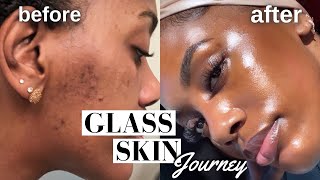 HOW I CLEARED MY HYPERPIGMENTATION ACNE AND DARK SPOTS  GLASS SKIN ROUTINE MUST WATCH [upl. by Avon]