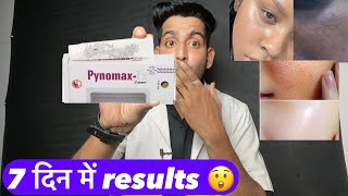 Pynomax tx cream  pynomax cream use  Pynomax tx cream how to use  Pynomax tx cream side effects [upl. by Anetta]