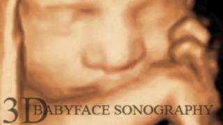 Best 3D 4D Baby Ultrasound  3D Babyface Sonography [upl. by Anicnarf]