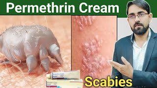 permethrin cream uses in hindi  scabies treatment in hindi  scabies permethrin cream Drx Rabbani [upl. by Aila]