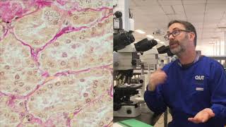 Microscope tutorial  Troubleshooting the Van Gieson stain [upl. by Darton]