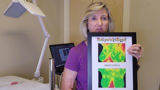 Thermography and Breast Health [upl. by Magavern100]