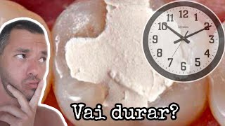 O CURATIVO DENTÁRIO dura QUANTO TEMPO no DENTE [upl. by Gargan]