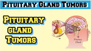 pituitary adenoma pathology [upl. by Osmo]