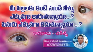 stickyeyes in babies  watery eyes in babies  causes amp treatment  Dr Madan Kumar cv [upl. by Yendirb842]