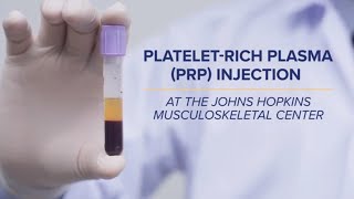 PlateletRich Plasma PRP Injections  QampA [upl. by Hobey]