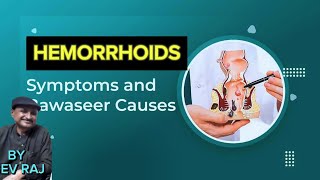 HaemorrhoidPiles بواسیر Bleeding per RectalConstipation [upl. by Ahsitram379]