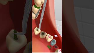 teeth cleaning by animation animation treatment kidsvideo satisfying relax [upl. by Nirre]