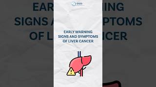 Early Warning Signs and Symptoms of Liver Cancer  Dr Aditya Kulkarni dradityakulkarni livercancer [upl. by Atenaz]