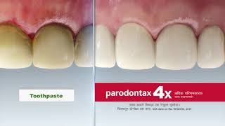 Parodontax toothpaste for healthy gums and strong teeth Marathi [upl. by Ivar]