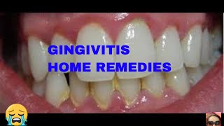 GINGIVITIS HOME REMEDIESESTERTOL [upl. by Salli165]