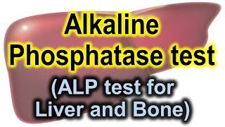 Alkaline phosphatase test  ALP test for liver and bones  ALP test [upl. by Siwel]