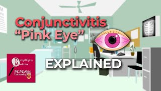 Conjunctivitis Pink Eye Explained [upl. by Oeniri670]