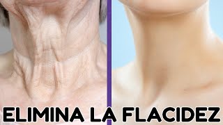 ELIMINAR ARRUGAS Y FLACIDEZ EN EL CUELLO ✨ Ejercicios para un Cuello Joven y Firme [upl. by Ariada286]