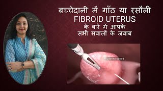 बच्चेदानी में गाँठ या रसौली  FIBROID UTERUS  All Questions Answered [upl. by Wharton]