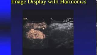 SONOWORLD Enhanced Ultrasound in the Abdomen Liver and Kidneys Edward G Grant MD [upl. by Richarda]