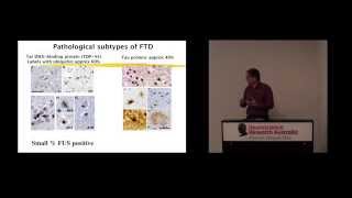 Frontotemporal dementia an overview [upl. by Eylatan951]