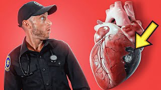 CARDIOGENIC SHOCK Explained In Under 6 Minutes [upl. by Eelreveb155]