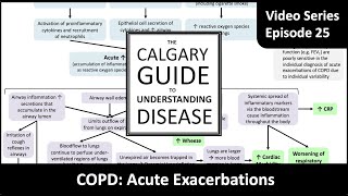 COPD Acute Exacerbations [upl. by Irahk]