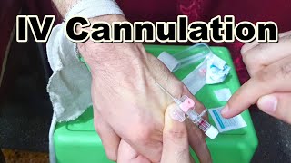 How to Insert IV Cannula  IV Cannulation Technique  Branula  Intravenous Catheter [upl. by Rosemarie]