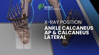 Xray Positioning Ankle Calcaneus AP and Calcaneus Lateral [upl. by Maxia321]