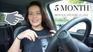 5 MONTH BRACES UPDATE 2019  I cant feel my face [upl. by Seabrook]