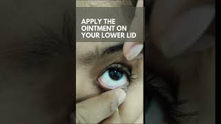 HOW TO APPLY EYE OINTMENT PROPERLY  NEW VISION EYE HOSPITAL MUNDAKAYAMPOONJAR [upl. by Ahsinej]