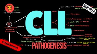 CHRONIC LYMPHOCYTIC LEUKEMIA Pathogenesis CLL Criteria Diagnosis Treatment [upl. by Bleier]