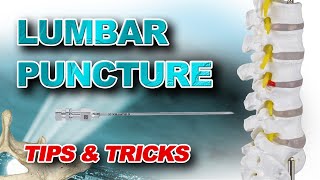 Lumbar Puncture Tips amp Tricks [upl. by Ardnazil636]