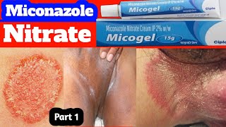 Fungal infection in private parts 🔥 jock itch treatment 💥 tinea cruris treatment 🔥 part1 [upl. by Aicilihp200]