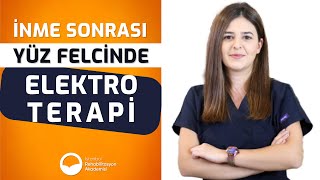 İnme Sonrası Yüz Felcinde Elektro Terapi [upl. by Shipley]